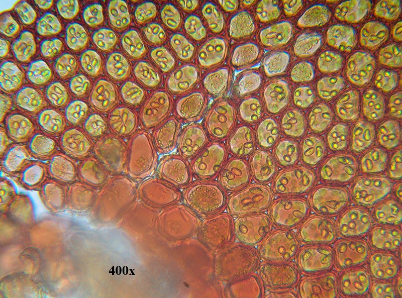 Calypogeia muelleriana?